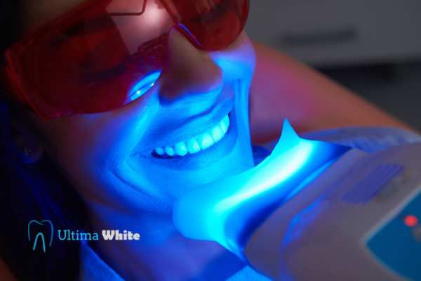 Professional Teeth Whitening Options Worcester