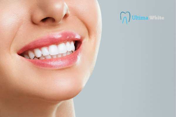Common Mistakes That Can Ruin Your Whitening Results Worcester