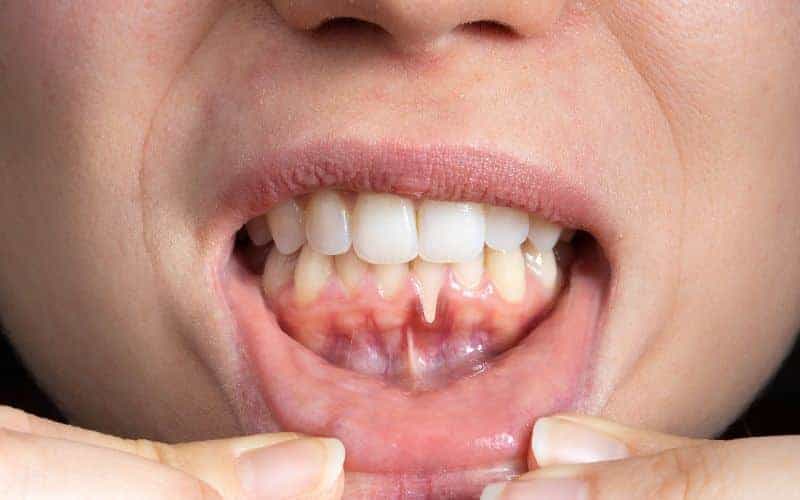Final Thoughts: Building Lifelong Enamel Protection Habits Worcester