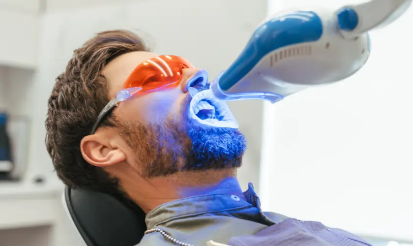The Hidden Differences Between DIY and Professional Teeth Whitening Worcester