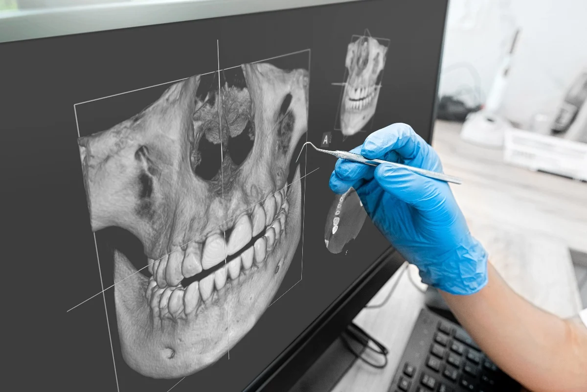 How Is AI Transforming Dental Treatment Planning Worcester?