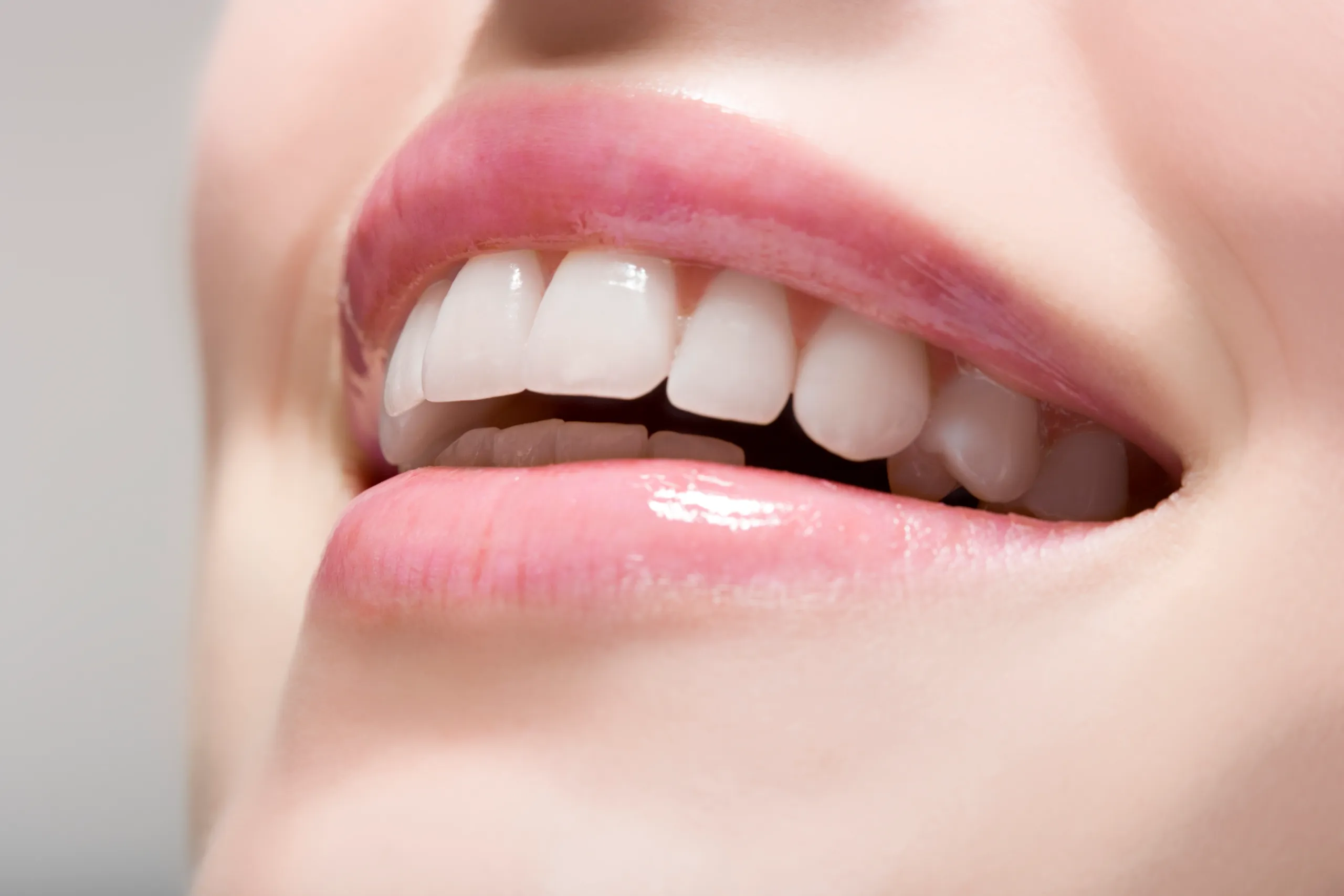 Myths and Misconceptions About White Spots Worcester