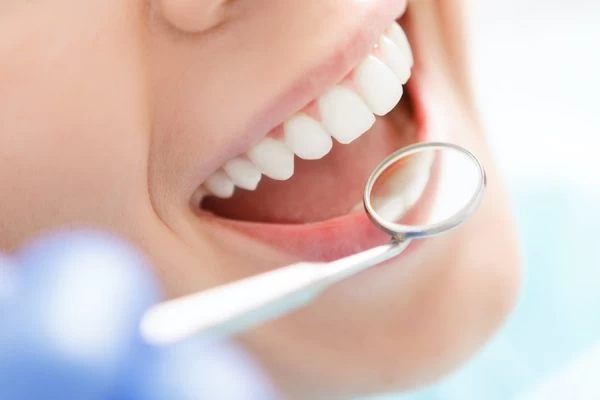 How to Maintain Your Whiter Smile After Treatment Worcester