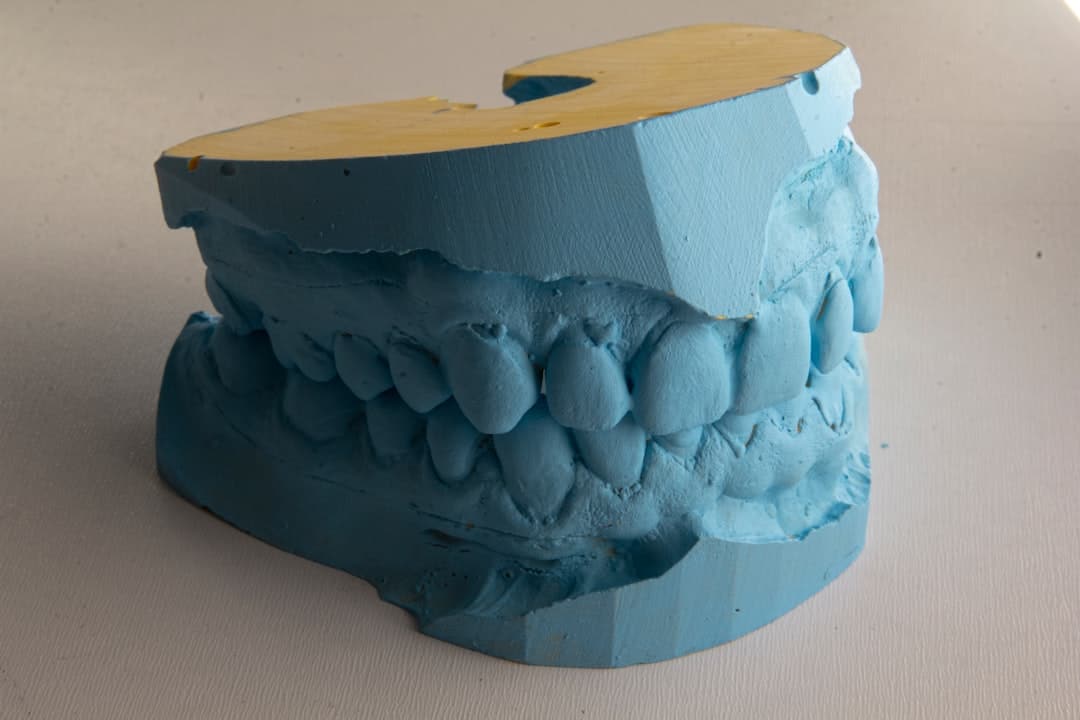How Do Dental Implants Improve Jawbone Health and Oral Function Worcester?