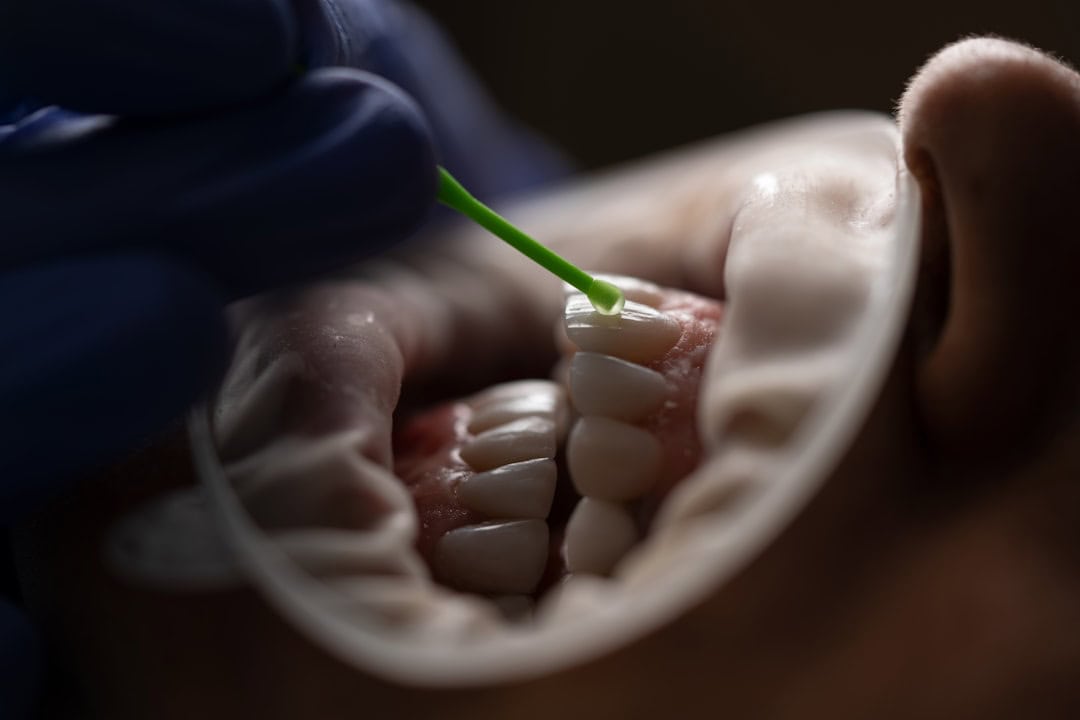 Common Causes of Persistent Dry Mouth Worcester