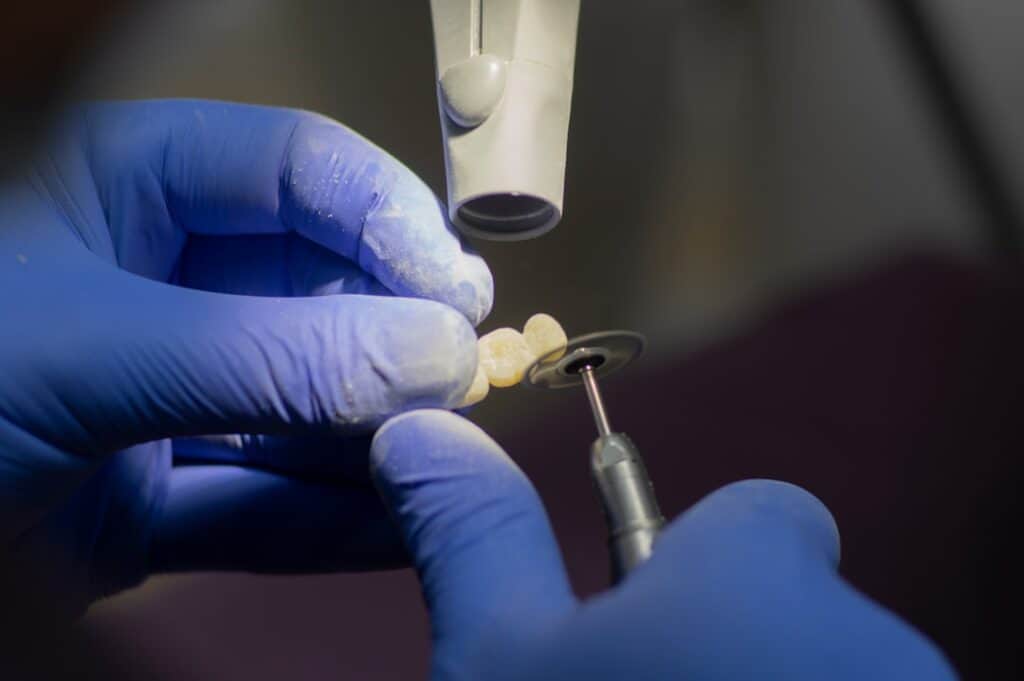 Customised Dental Solutions: Crowns, Aligners, and Implants Worcester